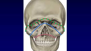 Facial Fractures 1 [upl. by Lexa]