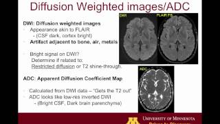 Brain MRI sequences 101 [upl. by Ahsiuqel]