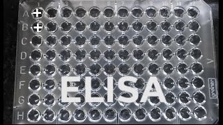 ELISA  How to do ELISA  step by step procedure for ELISA [upl. by Gokey]