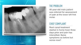 Advances in Endodontic Treatment Part 1Diagnosis and Treatment Planning [upl. by Pomeroy]