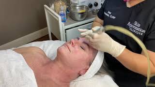 Microdermabrasion Facial Demonstration [upl. by Bevers729]