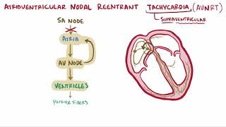 2Minute Neuroscience Pain and the Anterolateral System [upl. by Nylde]