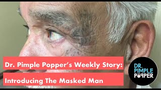 Dr Pimple Poppers Weekly Story Time Introducing the Masked Man [upl. by Zilada271]