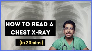 How to read a chest Xray in 20 mins [upl. by Yenor656]