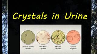 Urine Examination3 Crystals [upl. by Ethban296]