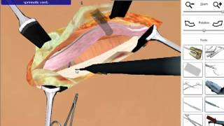 Hernia Repair  Open Surgery Simulation [upl. by Angil]