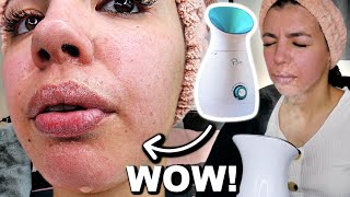 I Tested The Best FACIAL STEAMER On Amazon [upl. by Ardisj674]