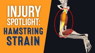 Injury Spotlight Hamstring Strain [upl. by Jann]