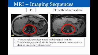 Introduction to Radiology Magnetic Resonance Imaging [upl. by Nereil171]