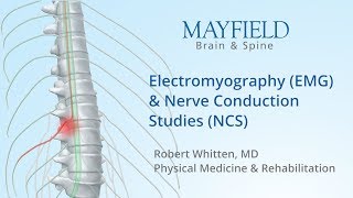 Muscle Twitching Fasciculations And Neuropathy [upl. by Rutter410]