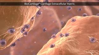 BioCartilage® Cartilage Extracellular Matrix [upl. by Lumbye147]