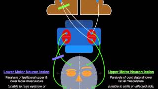 Facial Palsy Upper and Lower Motor Neuron Lesions  Dr MDM [upl. by Aisac135]