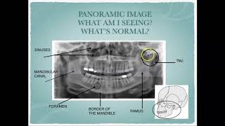 Radiographic Interpretation of Dental Anatomy [upl. by Mulligan]