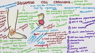 Squamous Cell Carcinoma  Pathology [upl. by Akired586]