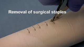 Placing and removing surgical wound closure staples [upl. by Ariom]