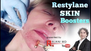 Restylane Skin Boosters [upl. by Livi615]