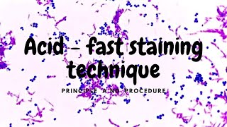 Acid fast Stain  principal and procedure [upl. by Wadesworth]