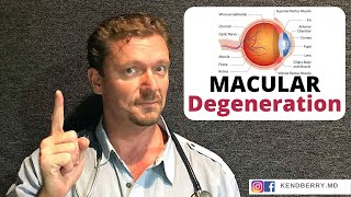 Medical Myth  Agerelated macular degeneration could now be cured 2 [upl. by Aicxela]