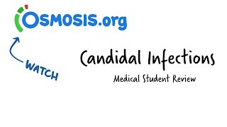 Candidal Infections Osmosis Study Video [upl. by Yoong]