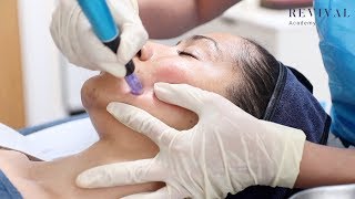 Microneedling Full Training Video [upl. by Ainek503]