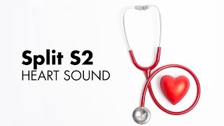 Fixed Split S2  Heart Sounds  MEDZCOOL [upl. by Nolyd737]