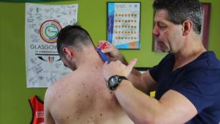 Trigger Point Therapy  Taping for Levator Scapulae [upl. by Lowis448]