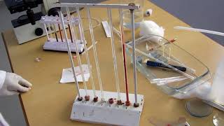 Erythrocyte sedimentation rate [upl. by Marelda]