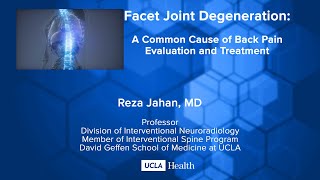 Facet Joint Degeneration A Common Cause of Back Pain Evaluation and Treatment [upl. by Lodovico]