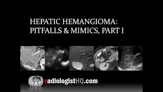 Hepatic Hemangioma Pitfalls amp Mimics Part I [upl. by Aicila]