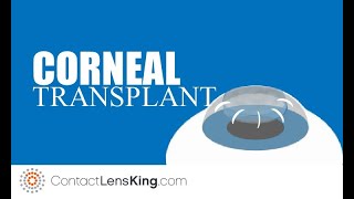 Corneal Transplant When Is It Necessary [upl. by Aicella773]