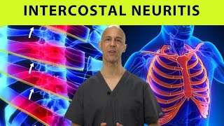 Intercostal Neuritis Relief Mid Back Pain Rib amp Chest Pain  Dr Mandell [upl. by Lonny916]