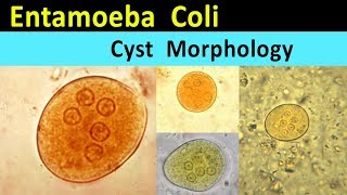 Amoebic dysentery  Entamoeba Histolytica [upl. by Ennaira]