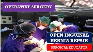 Tipos de hernia de hiato [upl. by Kare]