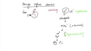 Pyloric Stenosis ULTRASOUND DISCUSSION 2 [upl. by Cerallua]