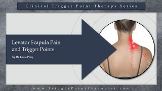 Levator Scapula Pain and Trigger Points [upl. by Ahseyn]