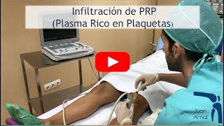 Infiltración Plasma Rico en Plaquetas PRP en TENDÓN ROTULIANO [upl. by Udela]