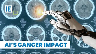 Will AI Cure Cancer [upl. by Marlane426]