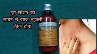 Scarab lotion  lindane and certified lotion  खाज खुलजी के दवा [upl. by Nereids439]