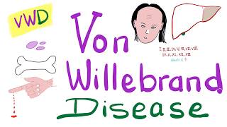 Von Willebrand Disease vWD  The Most COMPREHENSIVE Explanation  Hematology [upl. by Adhern]