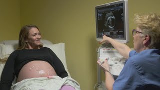 Ultrasounds during pregnancy [upl. by Eidak]