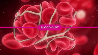 Coagulation Cascade Explained [upl. by Crescint]