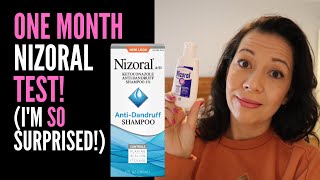 HAIR LOSS SUFFERER REVIEWS NIZORAL SHAMPOO One Month Review On 2 Ketoconazole IM VERY SURPRISED [upl. by Birmingham]