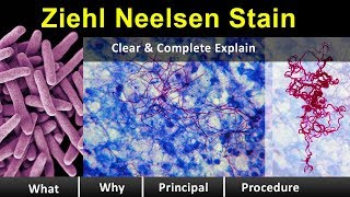 ziehl neelsen Stain  Clear amp Complete Overview [upl. by Deirdra]