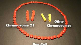 Nondisjunction Trisomy 21  An Animated Tutorial [upl. by Leelaj]