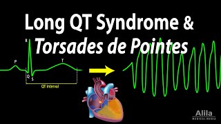 Long QT Syndrome and Torsades de Pointes Animation [upl. by Ulah335]