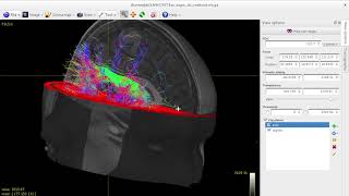 Tractography of arcuate fasciculus using MRtrix3 [upl. by Ecirtnom]