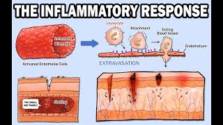 THE INFLAMMATORY RESPONSE [upl. by Valry453]