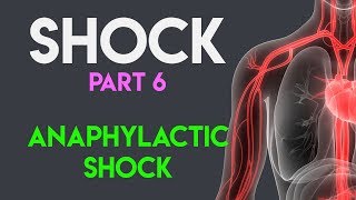 Anaphylactic Shock  Shock Part 6 [upl. by Teraj]