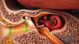 How the Ear Works  3D Medical Animation  ABP © [upl. by Bonney]