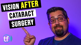 Cataract Surgery how it is performed [upl. by Tillion70]